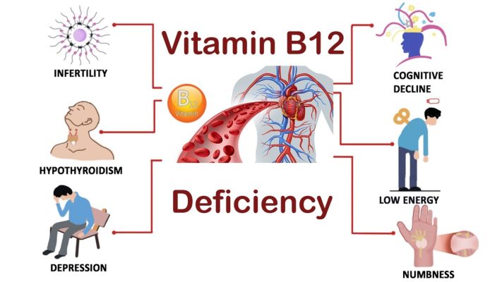 Vitamin B12 và bệnh thiếu máu ác tính